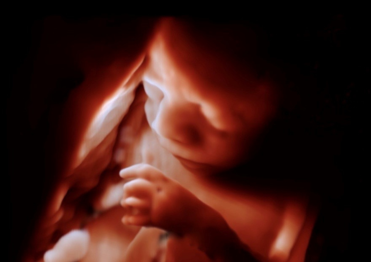 fetal-ultrasound
